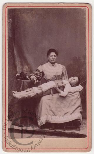 Child in full body splint