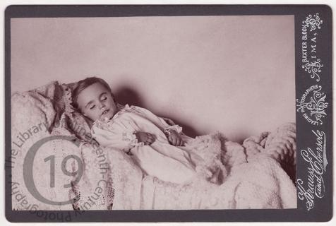 Child with prominent front teeth